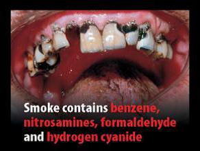 Jersey 2012 Consituents - diseased organ, benzene, nitrosamines, formaldehyde, hydrogen cyanide
